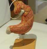 Prikaz namestitve obročka okrog spodnjega dela želodca, s čemer se zmanjša njegov volumen.