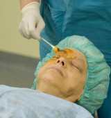 Medicinska sestra dezinficira področje okoli očesa